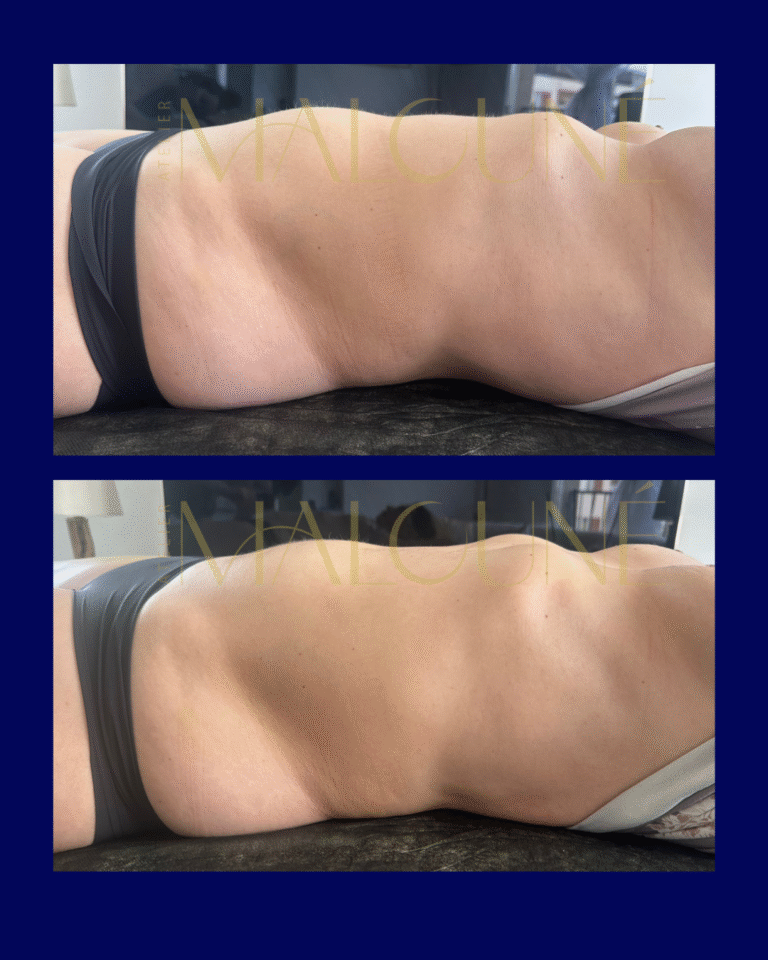 Drainage lymphatique à domicile à Villebon-sur-Yvette – Atelier Malouné